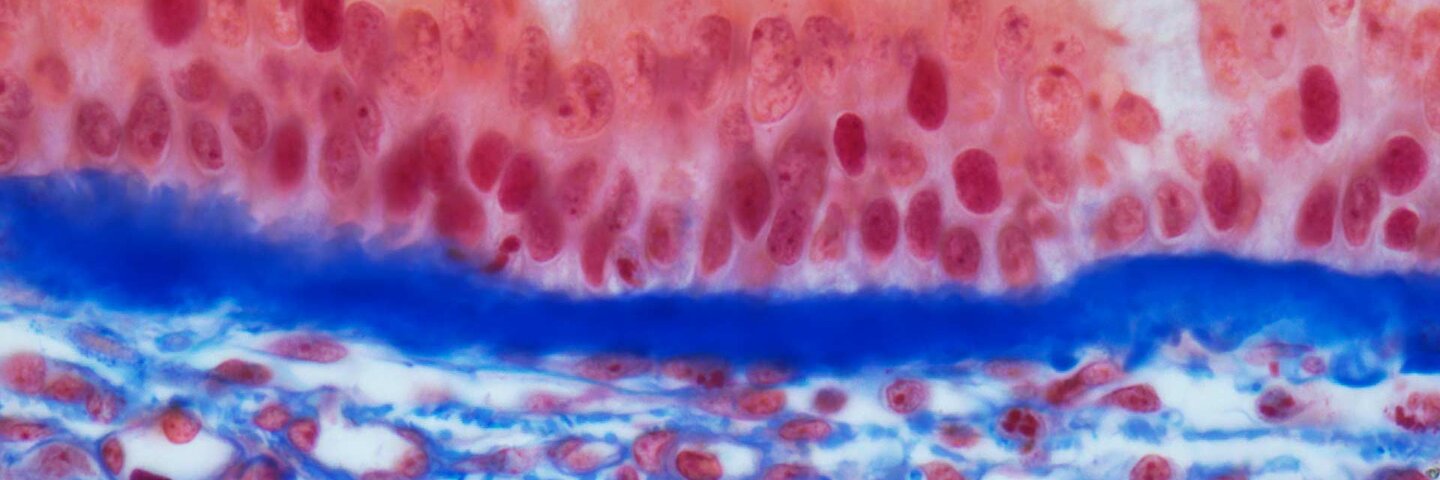 Trachea epithelium. Light micrograph 